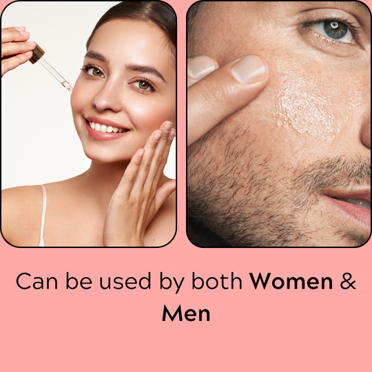 Serum Niacid Fill in Pitted Scars & Dark Acne - 50ml